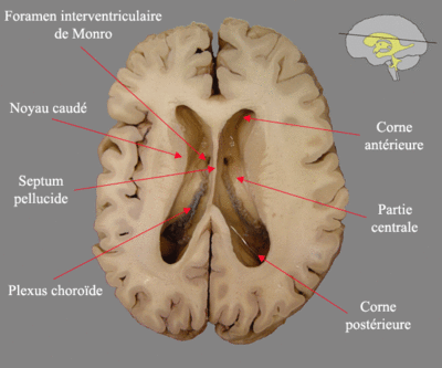 coupe horizontale.gif