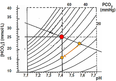 alcalose respiratoire.png