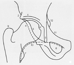 U radiologique de Calot - copie.jpg