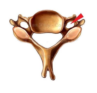 cervical-_transverse_foramen1306526115377.jpg