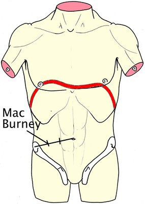 Point de Mac Burney.jpg