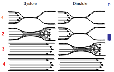 Auscultation brassard.PNG