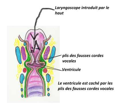 ventricule.png