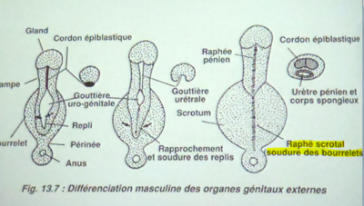 raphé scortal 2.PNG