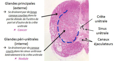 crête urétrale.PNG