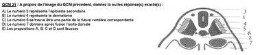 QCM 21DM.png