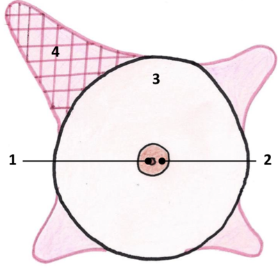 processus axillaire.png