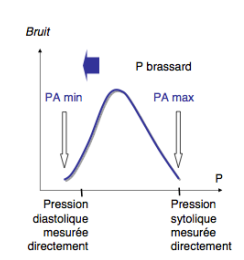 bruits auscultation.png