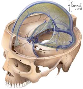 tente-sinus (1).JPG