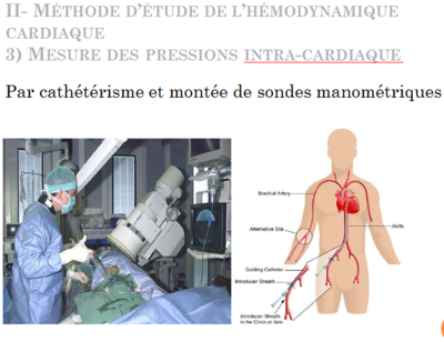 pression artérielle.PNG