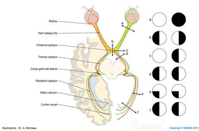 2-optic-nerve-anatomy-illustration-en_medical512.jpg