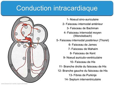 conductionintracardschema.jpg