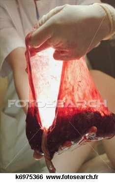 placenta-k6975366.jpg