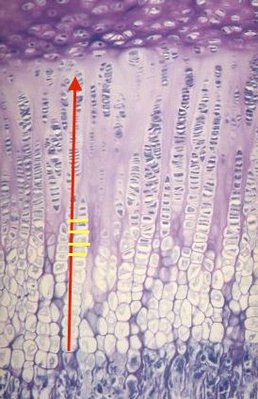 cartilage de conjugaison métaphysaire.jpg