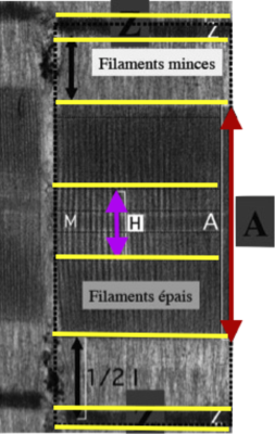Striation en ME muscle squelettique.png