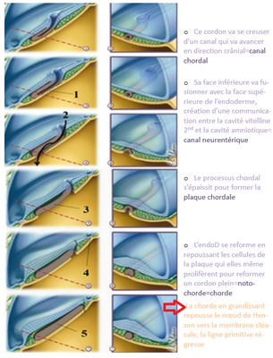 Mise en plca de la chorde.png