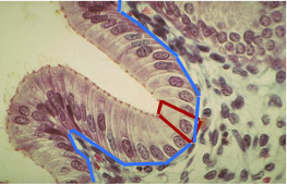 Unistratifié cylindrique.png