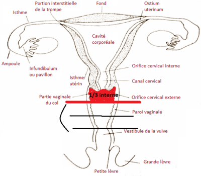 utérus.PNG