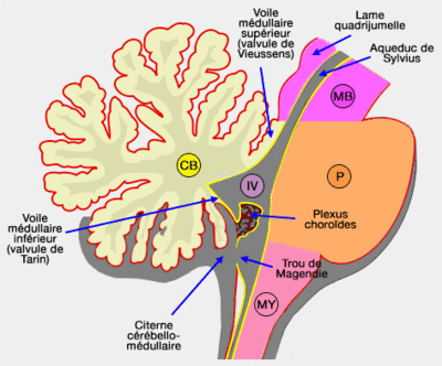 plexus-ventricule-4.gif