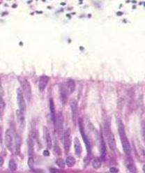 Microvillosité.PNG