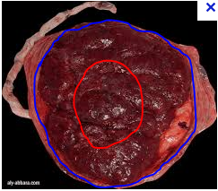 placenta.PNG