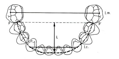 Mesure standard des arcades.JPG