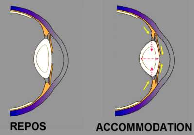Accomodation cristallin.PNG