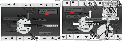 Formation thrombus.png
