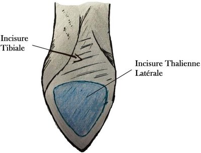 incisure tibiale.jpg