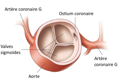 aorta-valve-en-ostium-e1401477859158.gif