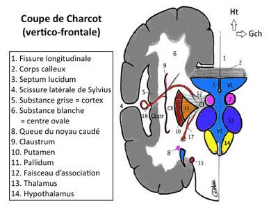 Charcot.jpg