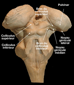 tronc-cerebral-dorsal.gif