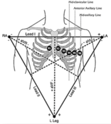 Capture d’écran 2016-03-10 à 14.17.48.png