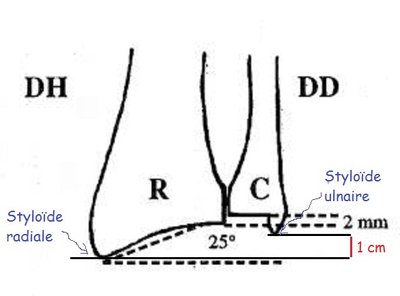 Styloïde - Copie.jpg