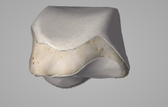 Capture d’écran 2016-03-18 à 17.56.35.png