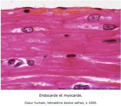 Endocarde.jpg