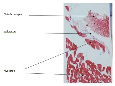 ENDOCARDE.jpg