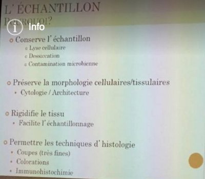 Echantillonage_2.jpg