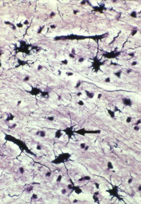 Astrocytes.png
