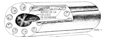 Schwann amyélinique.png