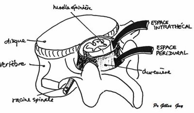 péridurale et intrathécale.jpg