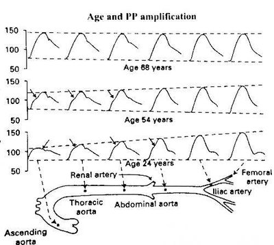 pression différentielle.jpg