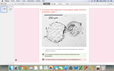 Capture d’écran 2017-09-23 à 14.41.31.png