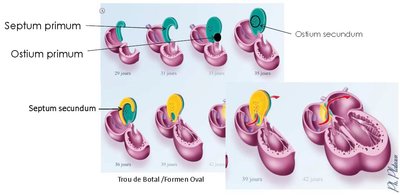 septums primum & secudum.jpg
