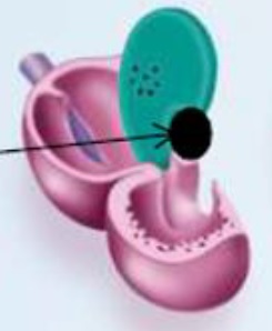 septum primum + ostium primum.jpg