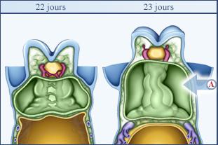 Tubes Endocardiques.jpg