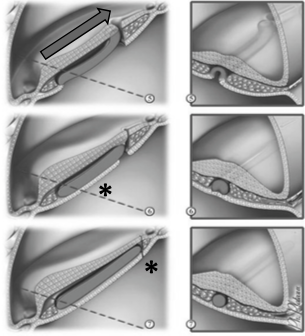 Capture d’écran 2017-11-9.png