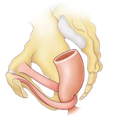 Sans titre copie.png