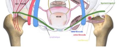 pédicule cuisse.JPG
