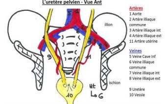 Vessie-uretères.JPG